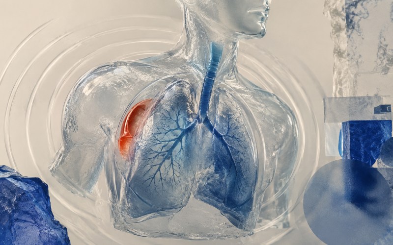 Abstract lung warning for unresolved pneumothorax