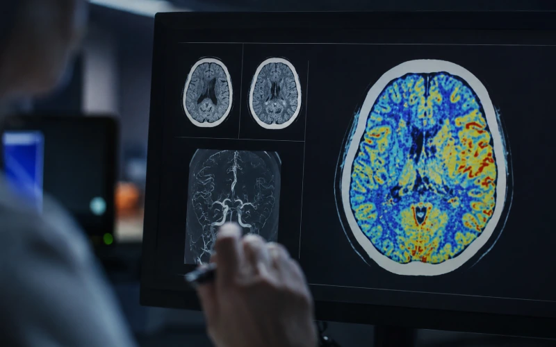 Brain imaging used to assess treatment effects